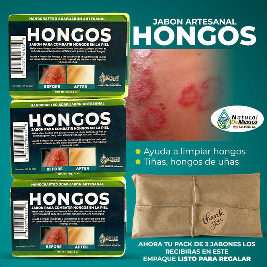Hongos, 3 Pack Anti Fungal Soap Bar